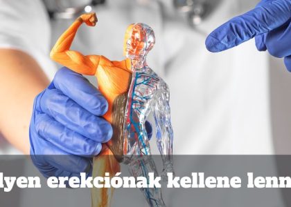 Milyen erekciónak kellene lennie?