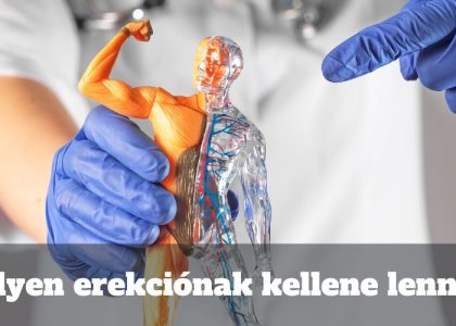 Milyen erekciónak kellene lennie?